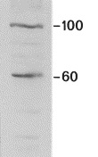 Figure 1. Western blot of MUB0309P, clone SR-3 on a mitochondrial preparation of swine heart, showing the two different variants of cardiotin.